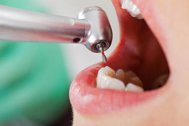 Best Weekend Emergency Dentist in Richmond, IN